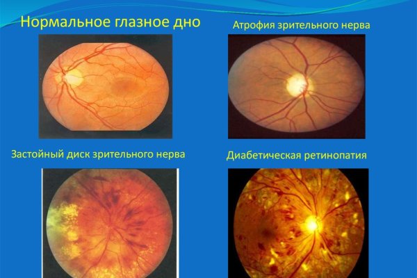 Кракен сайт покупок